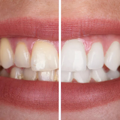 AquaBrite™ Smile Bright